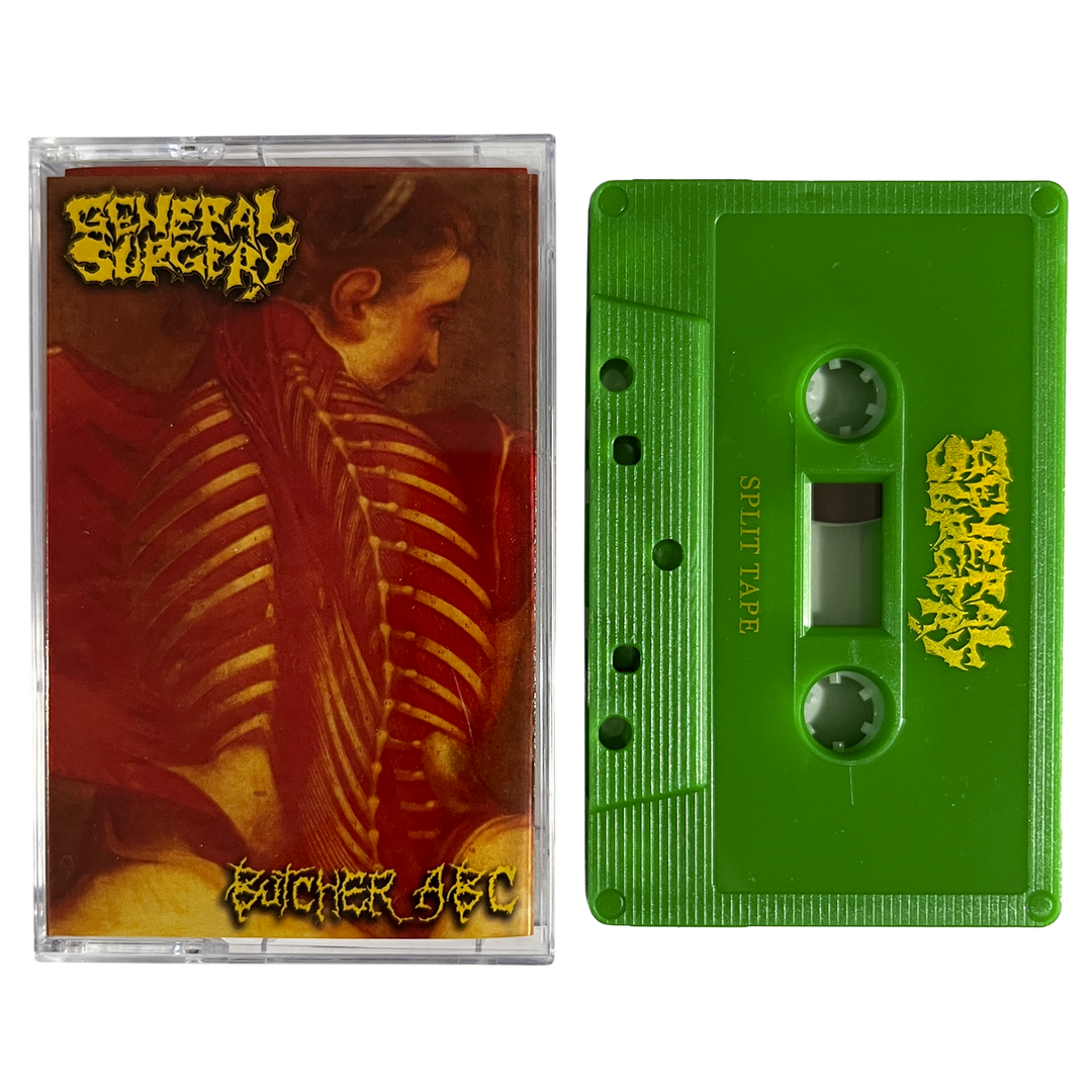 General Surgery / Butcher ABC 'Split Tape' Cassette