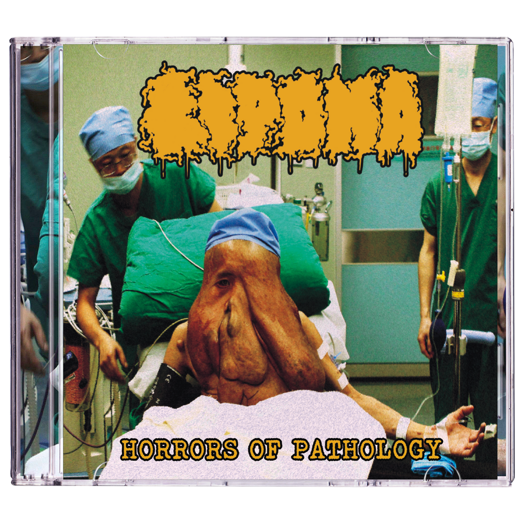 Lipoma 'Horrors Of Pathology' CD *PRE-ORDER*