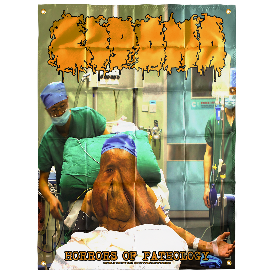 Lipoma 'Horrors Of Pathology' Flag *PRE-ORDER*