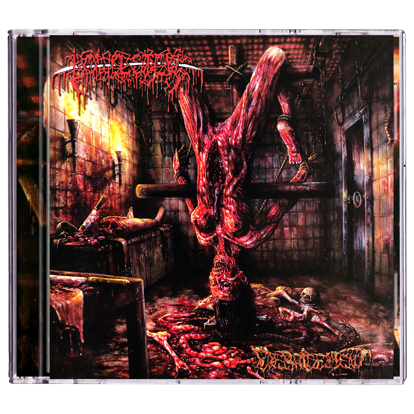 Bowel Stew 'Debridement' CD