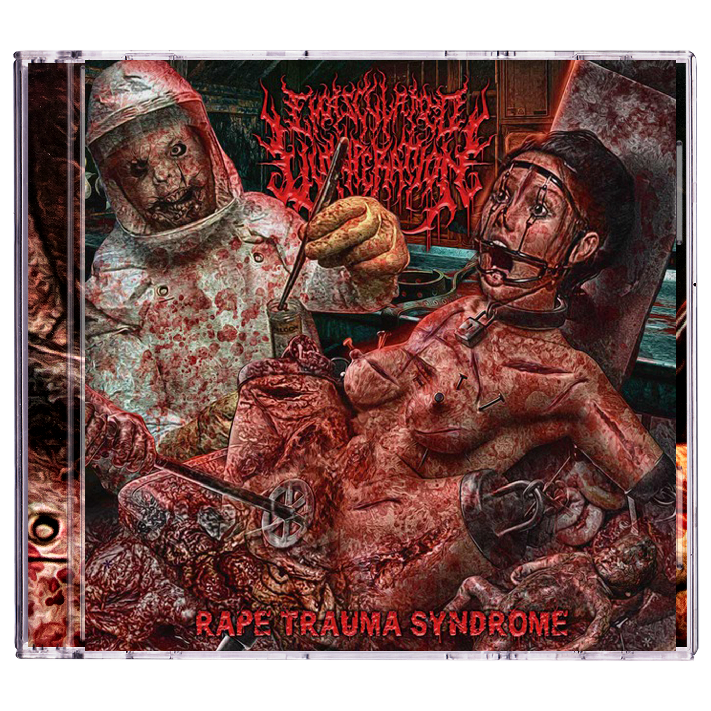 Emasculated Vituperation 'Rape Trauma Syndrome' CD