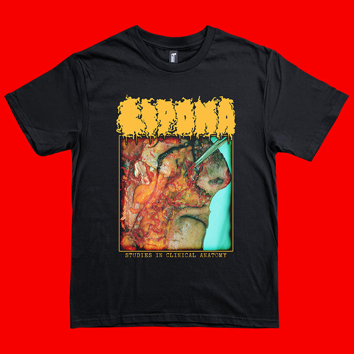 Lipoma "Studies in Clinical Anatomy" Long Sleeve