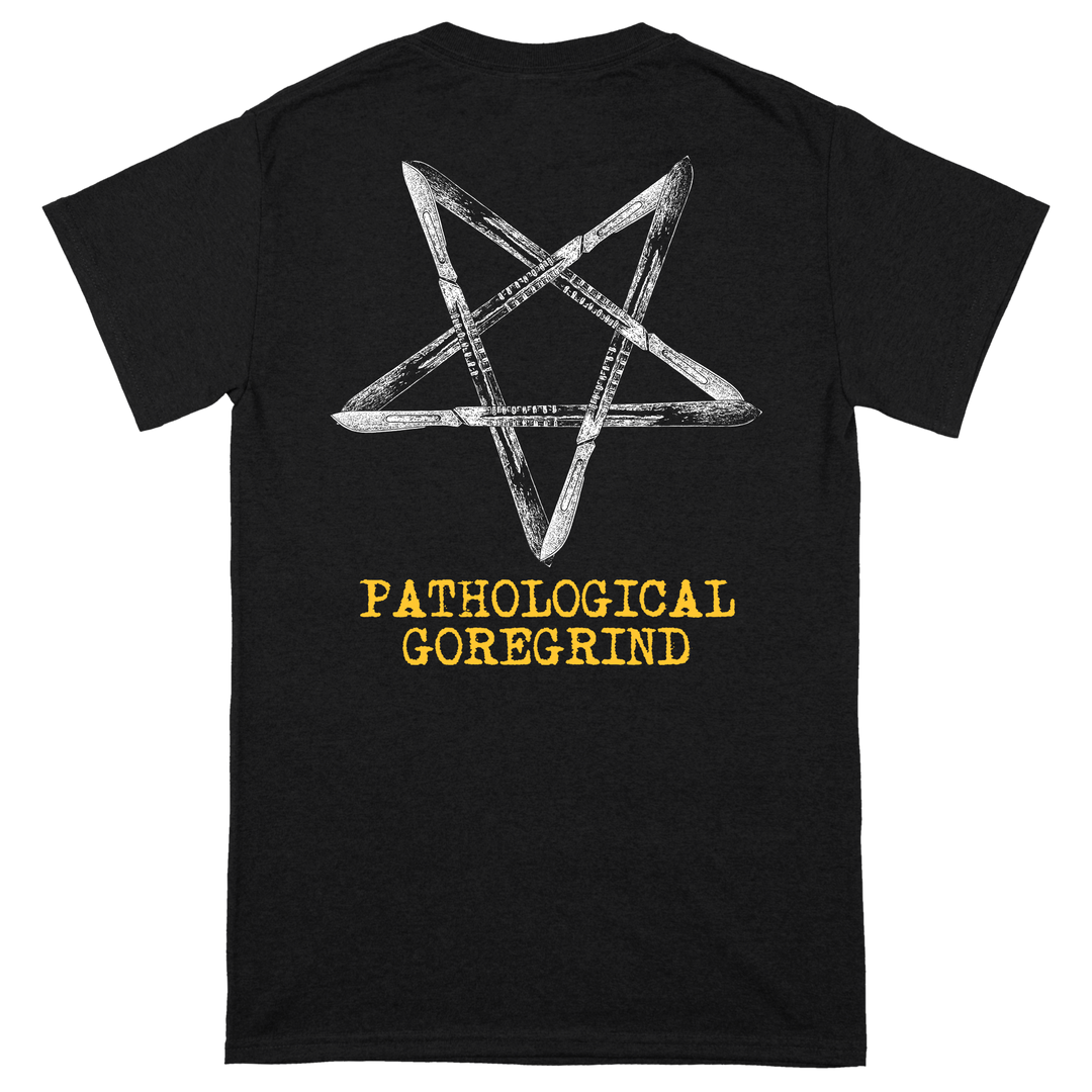 Lipoma 'Guide Thy Surgeon's Hand' T-Shirt *PRE-ORDER*