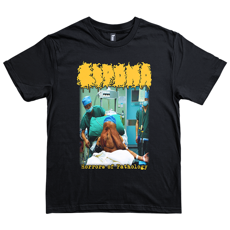 Lipoma "Horrors of Pathology" T-Shirt