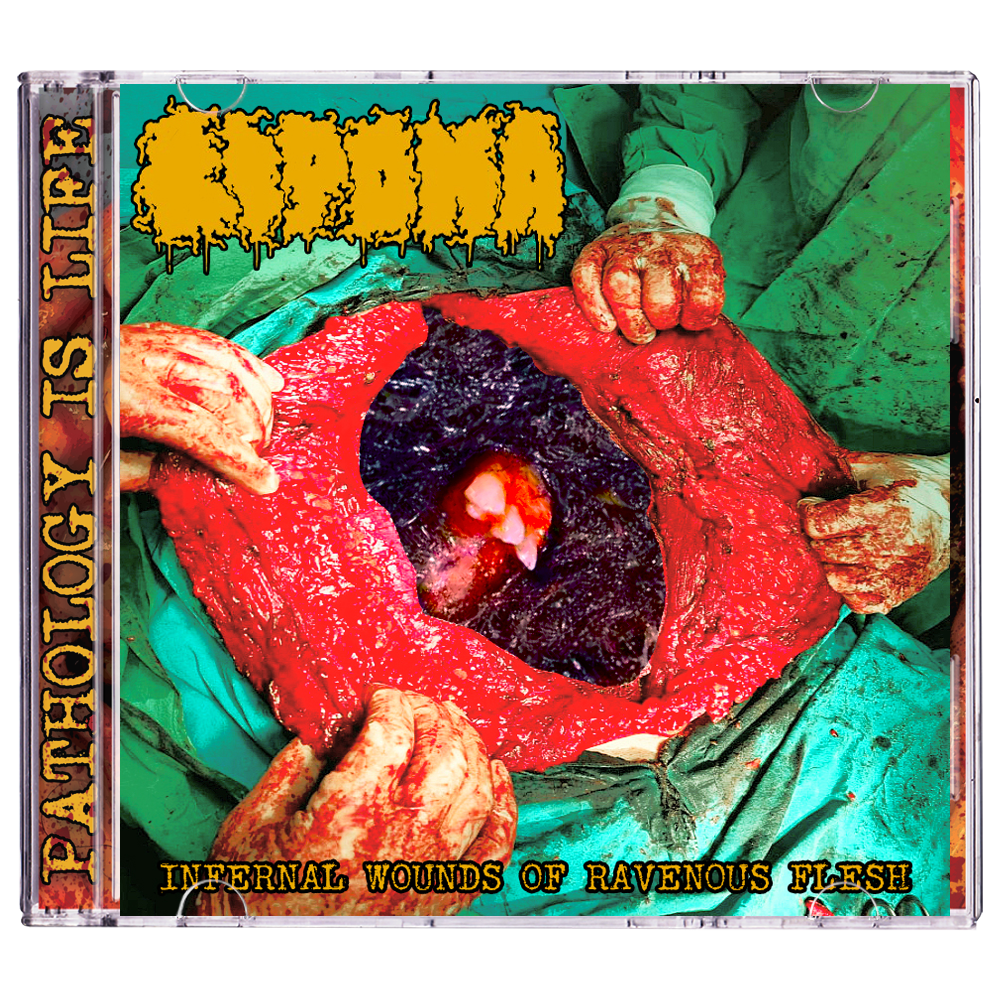 Lipoma "Infernal Wounds of Ravenous Flesh" CD *PRE-ORDER*