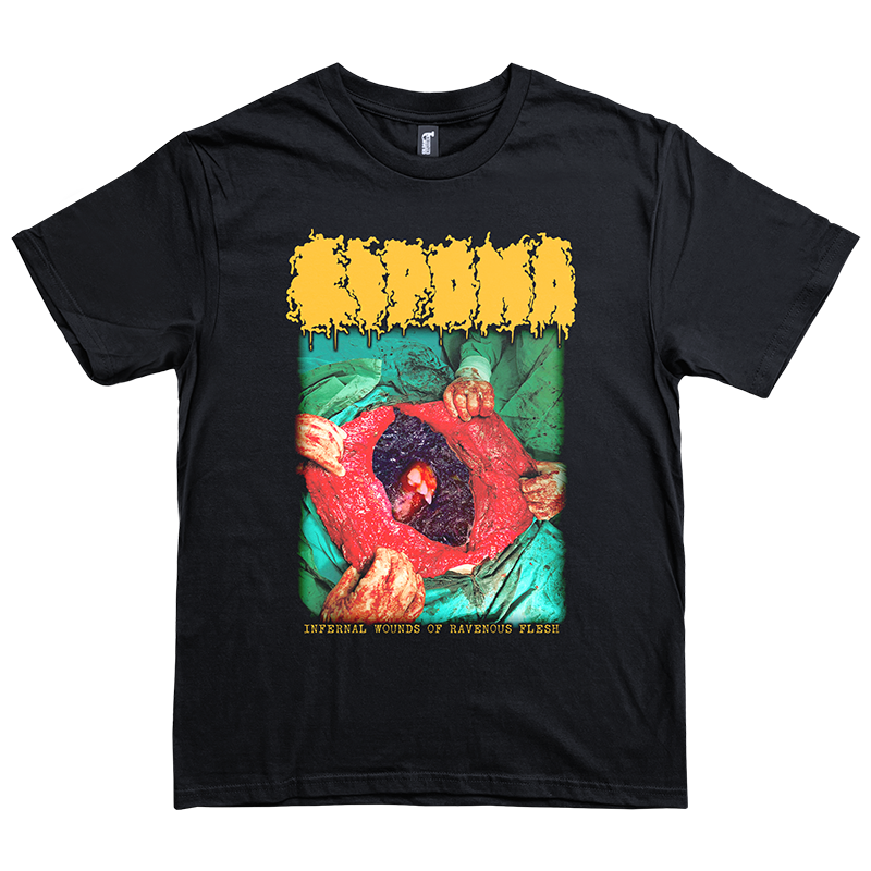 Lipoma "Infernal Wounds of Ravenous Flesh" T-Shirt