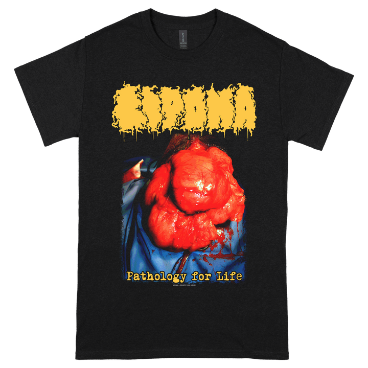 Lipoma 'Pathology For Life' T-Shirt *PRE-ORDER*