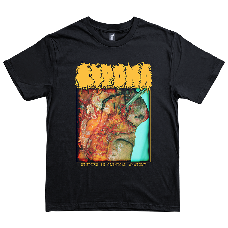 Lipoma "Studies in Clinical Anatomy" T-Shirt