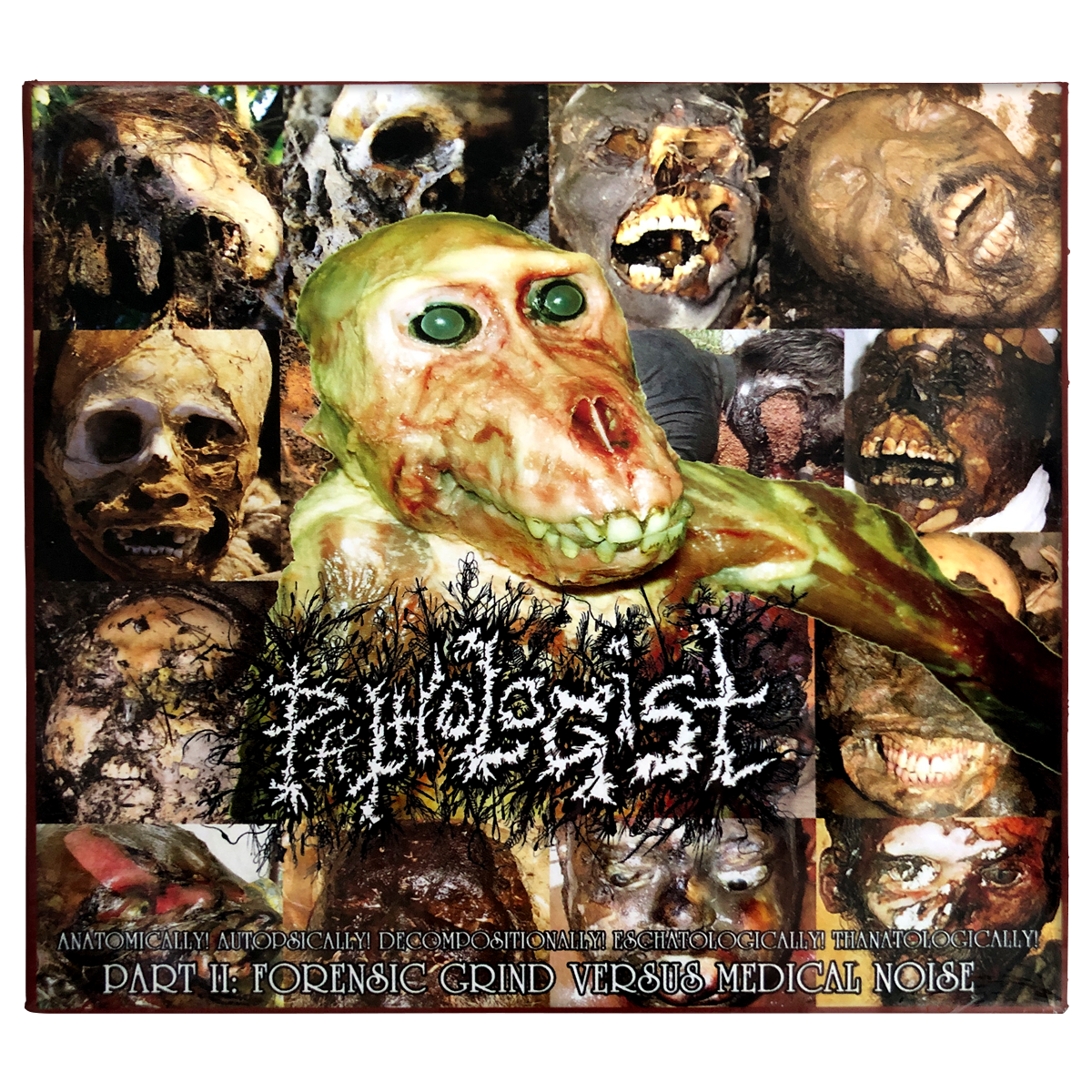 Pathologist 'Anatomically! Autopsically! Decompositionally! Eschatologically! Thanatologically! (Part II: Forensic Grind Versus Medical Noise)' Digipak 2xCD