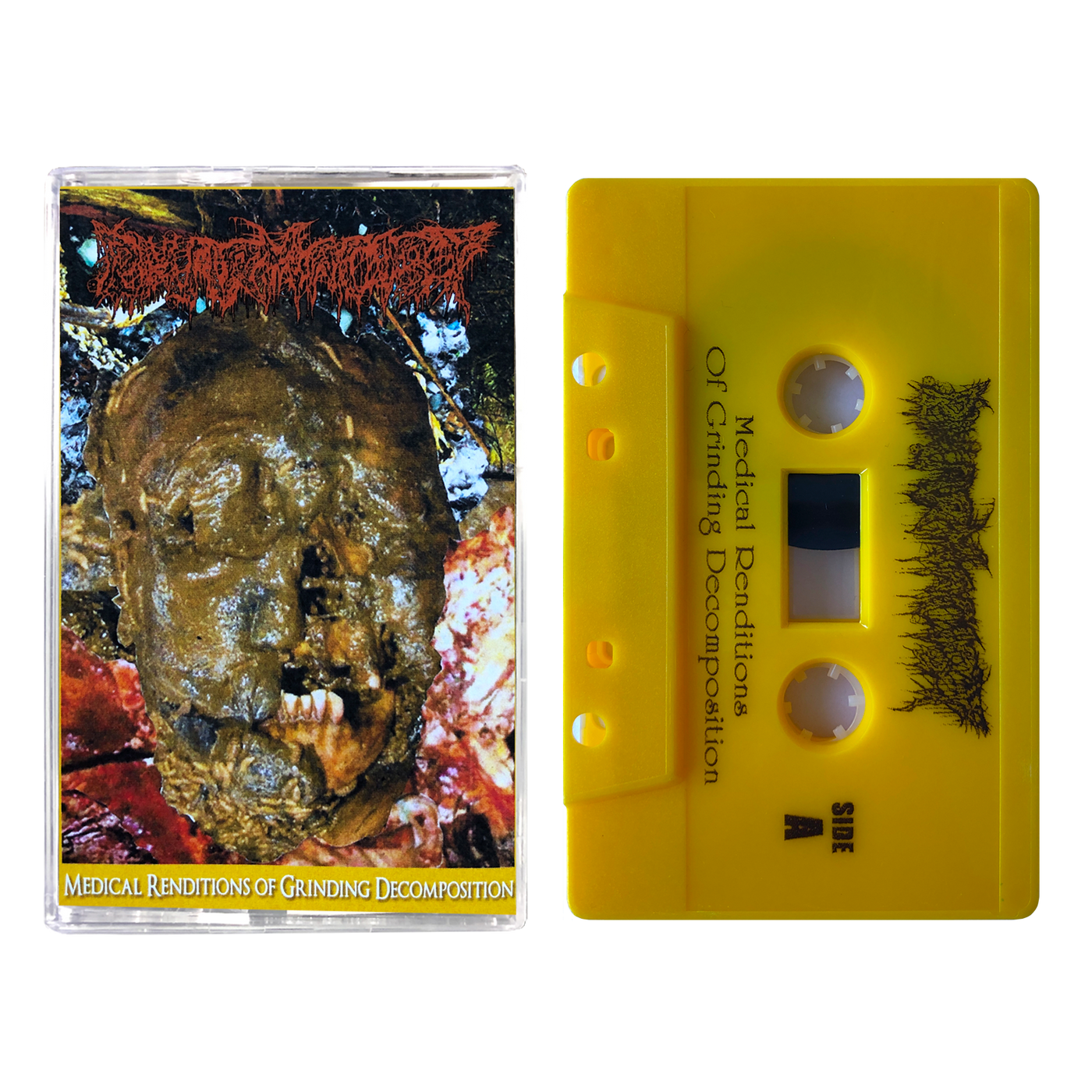 Pharmacist 'Medical Renditions Of Grinding Decomposition' Cassette
