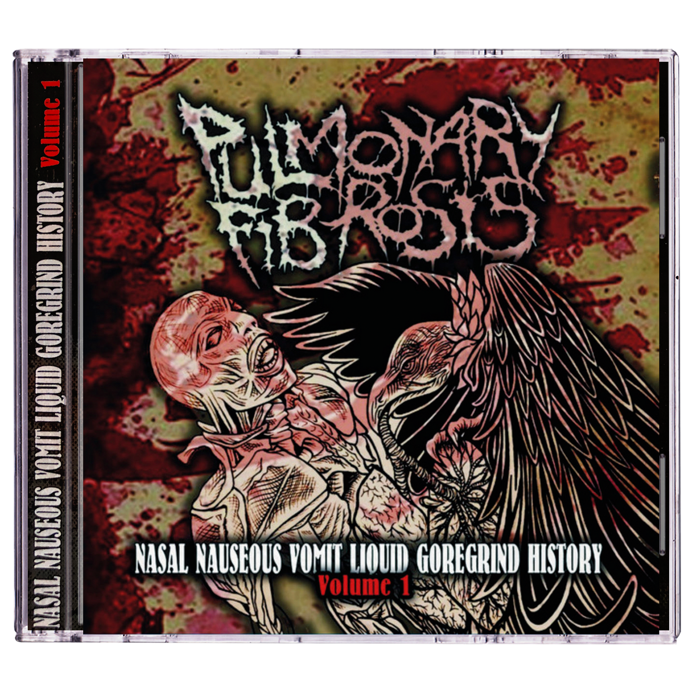 Pulmonary Fibrosis 'Nasal Nauseous Vomit Liquid Goregrind History Volume 1' CD