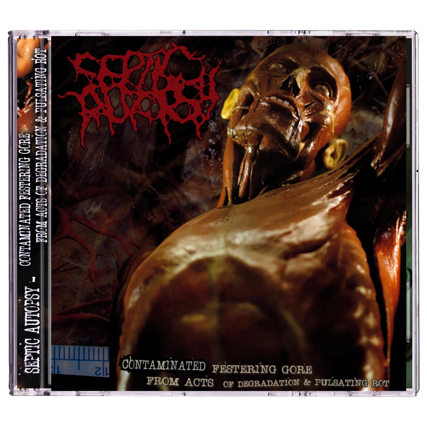 Septic Autopsy 'Contaminated Festering Gore From Acts of Degradation & Pulsating Rot' CD