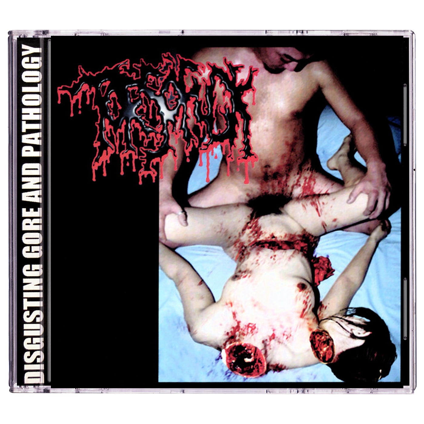 Torsofuck / Lymphatic Phlegm 'Disgusting Gore And Pathology / Polymorphisms To Severe Sepsis In Trauma (Split)' CD