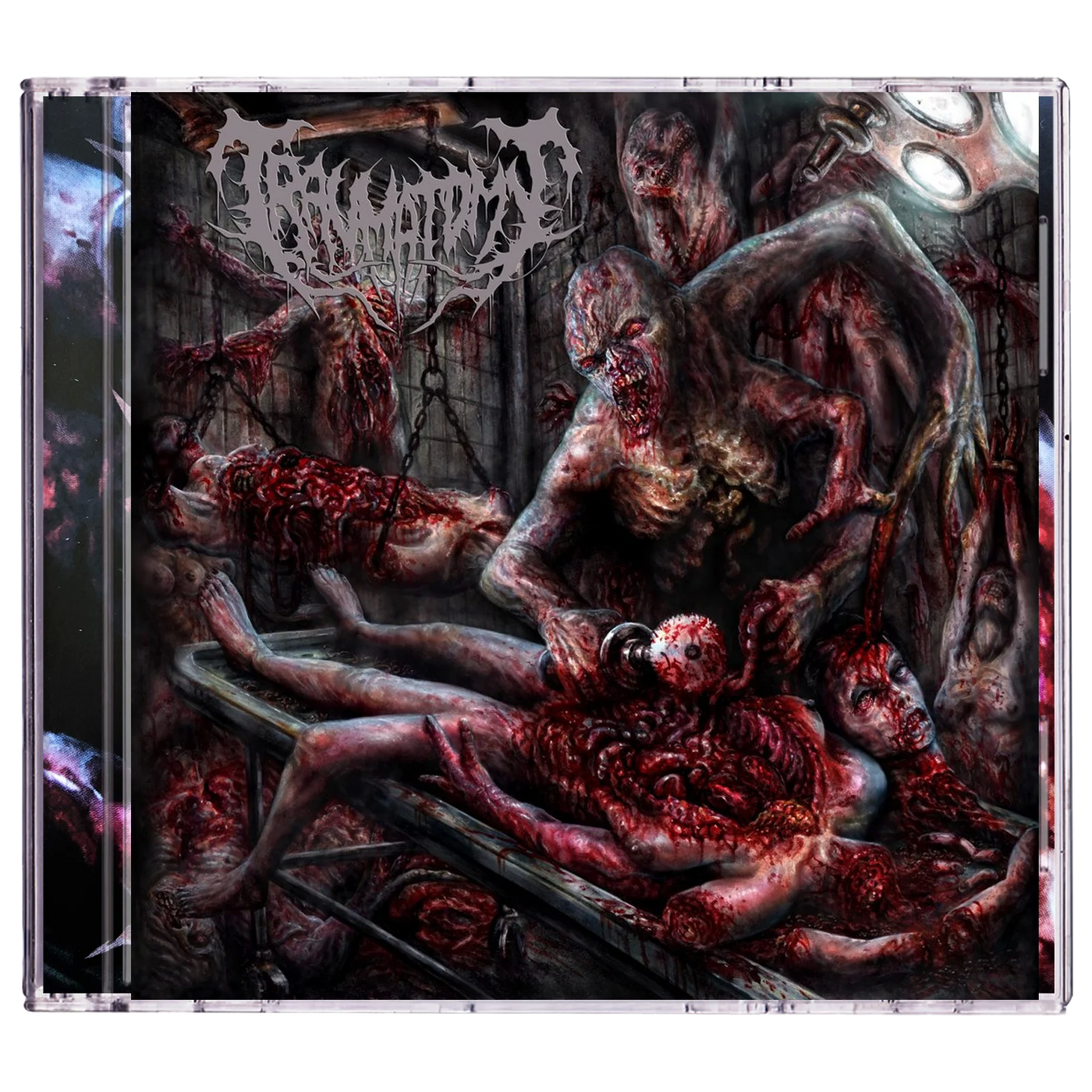 Traumatomy 'Beneficial Amputation Excess Limbs' CD