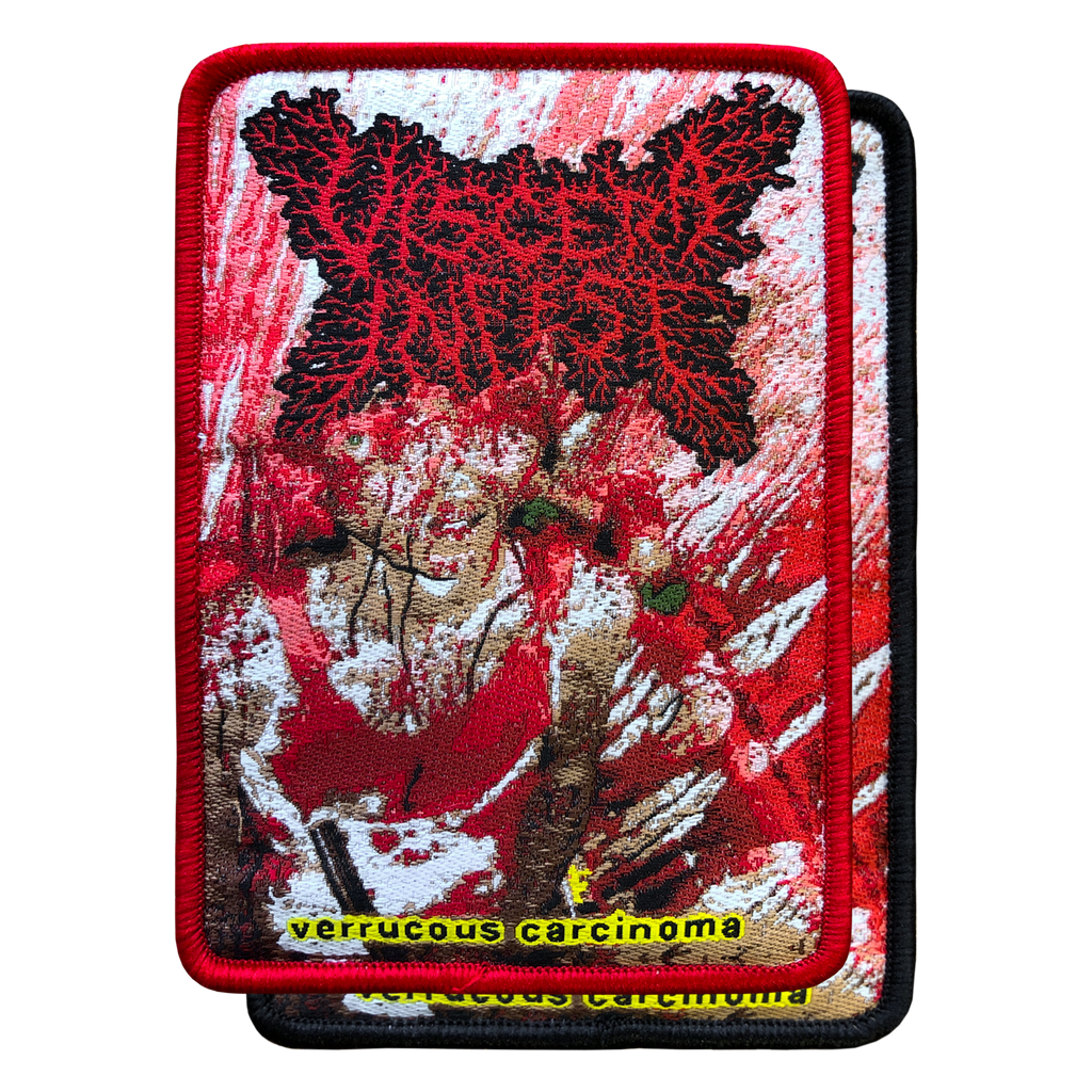 Viscera Infest 'Verrucous Carcinoma' Patch – Reality Fade Merch