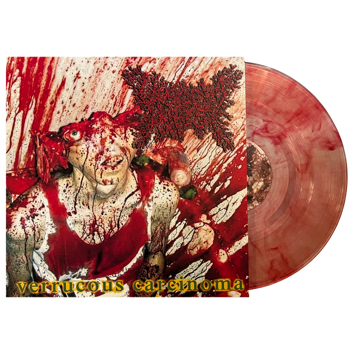 Viscera Infest 'Verrucous Carcinoma' LP – Reality Fade Merch