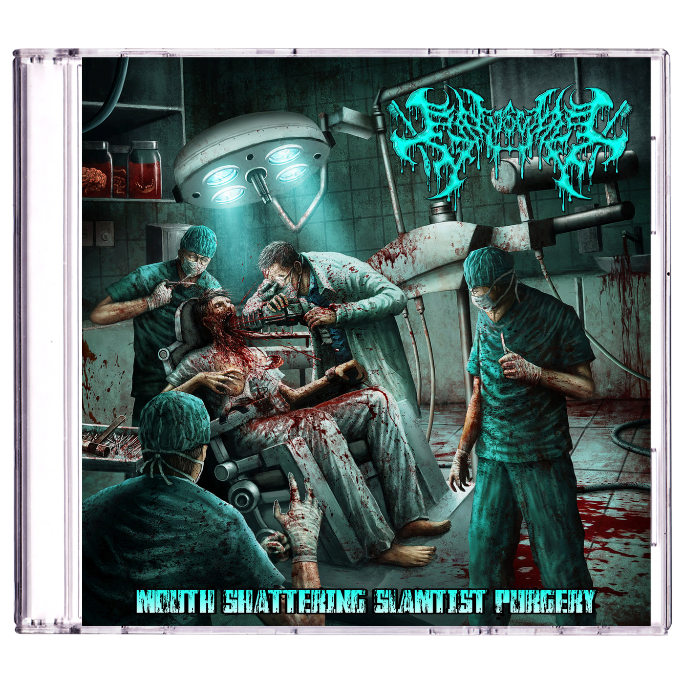 Gingivectomy 'Mouth Shattering Slamtist Purgery' CD