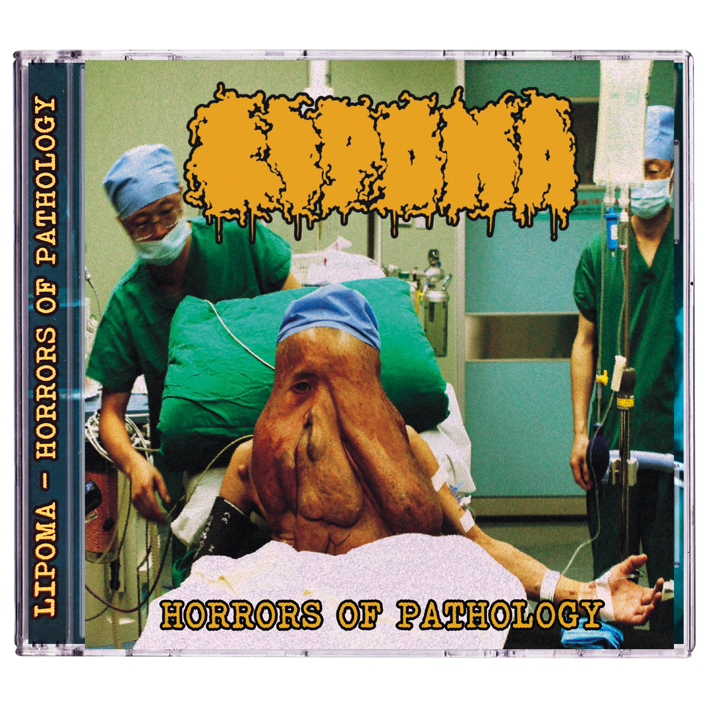 Lipoma 'Horrors Of Pathology' CD
