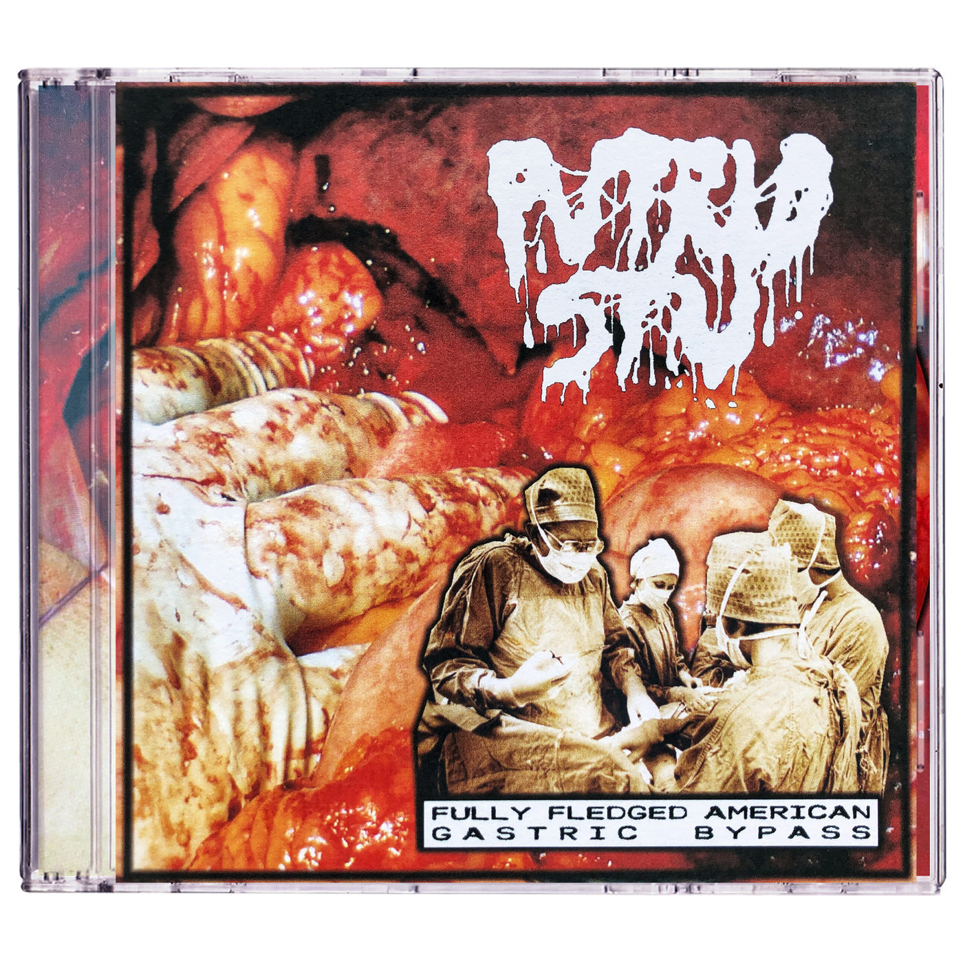 Putrid Stu 'Fully Fledged American Gastric Bypass' CD