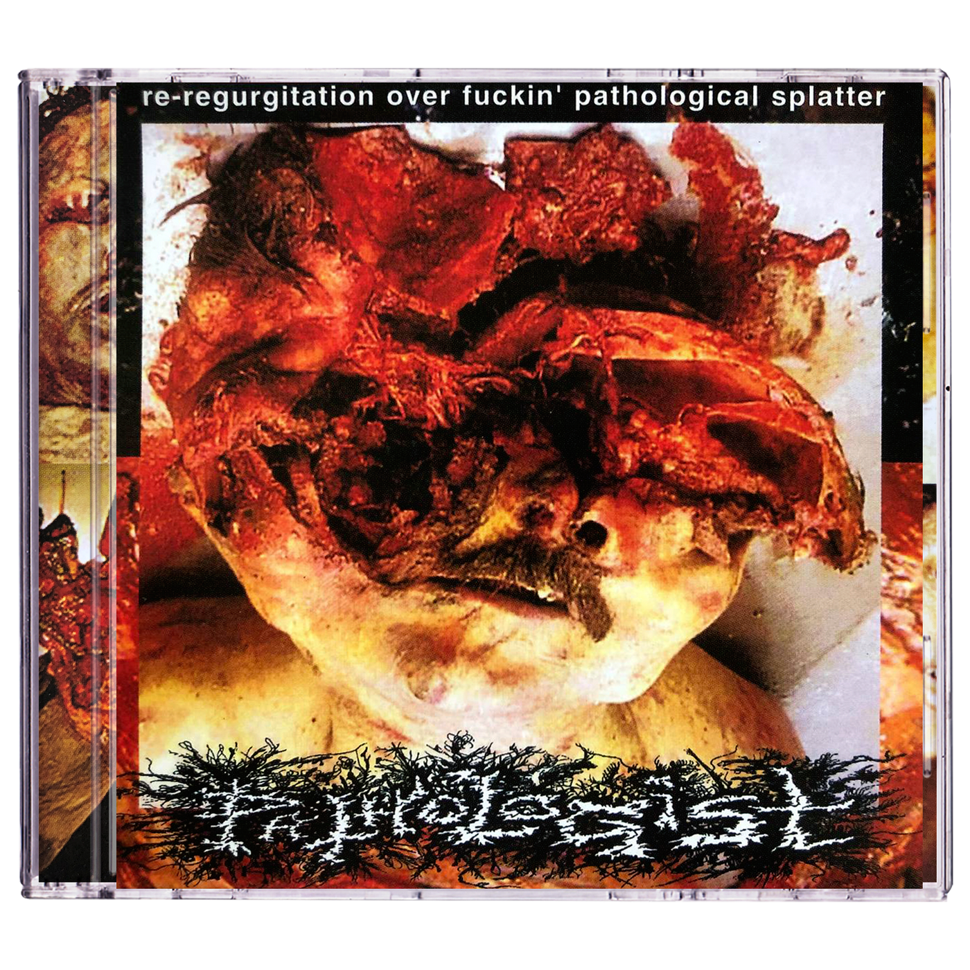 Pathologist 'Re-regurgitation over fuckin' pathological splatter' CD