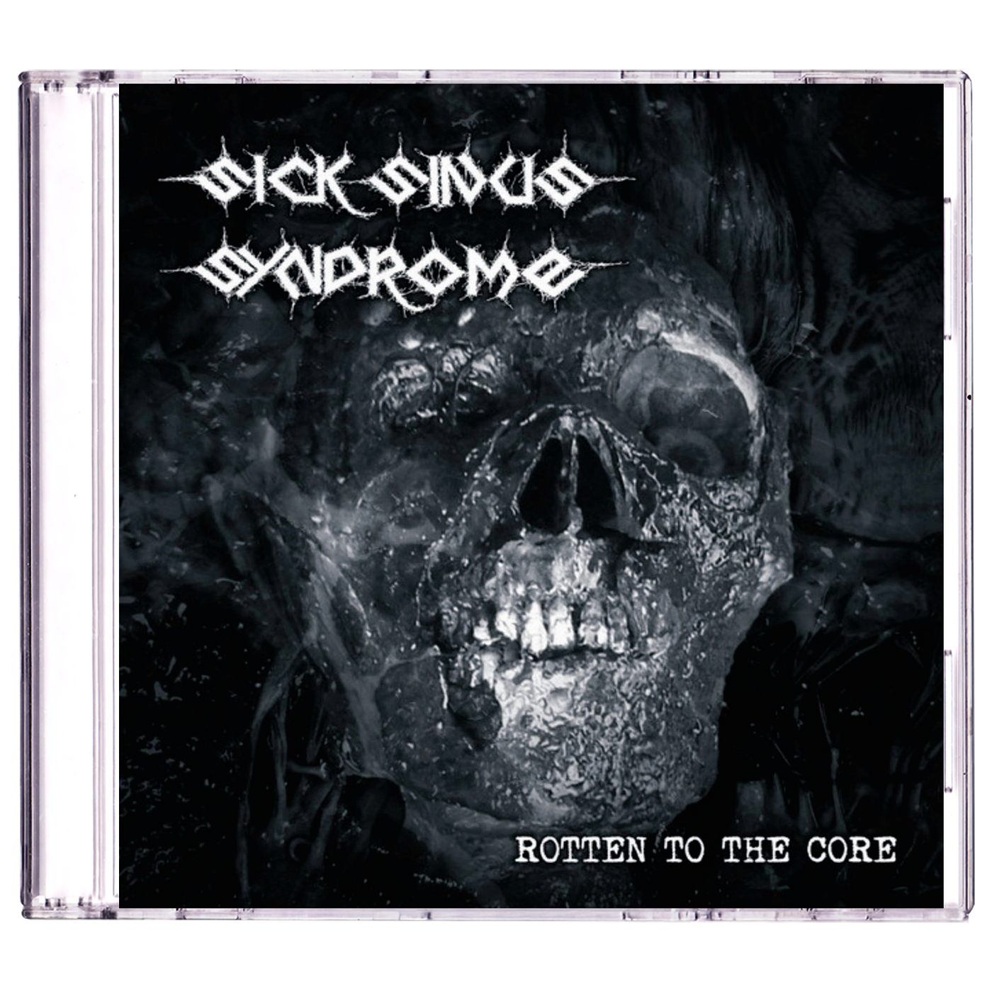 Sick Sinus Syndrome 'Rotten To The Core' CD
